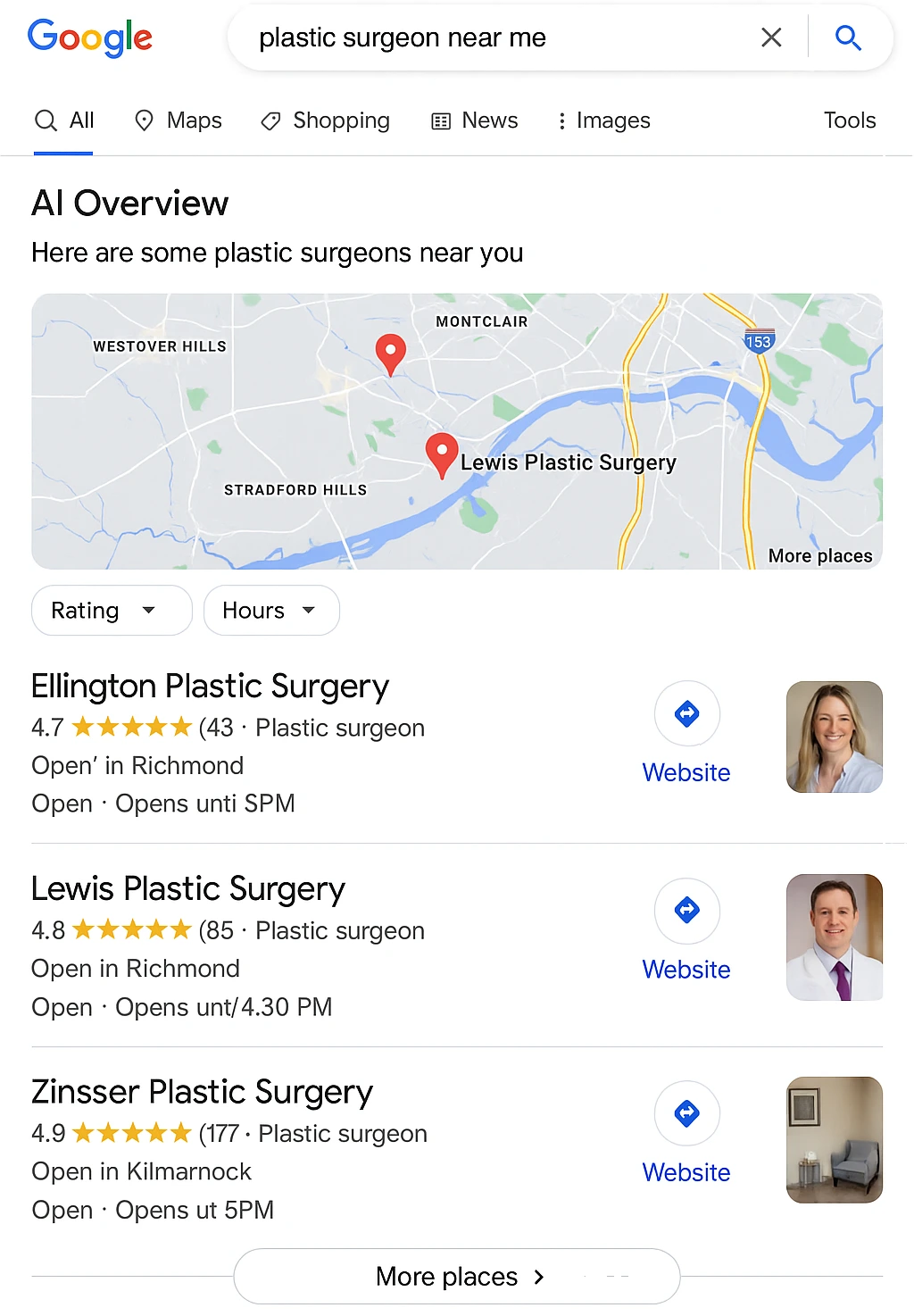 Plastic Surgery Marketing Strategies: Proven Ways to Grow Your Practice 1 Local SEO for Plastic Surgeons